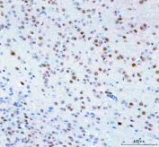 IHC staining of FFPE mouse brain tissue with Islet 1 antibody. HIER: boil tissue sections in pH8 EDTA for 20 min and allow to cool before testing.