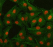 Immunofluorescent staining of FFPE human A549 cells with Islet 1 antibody (red) and Beta Tubulin mAb (green). HIER: steam section in pH6 citrate buffer for 20 min.