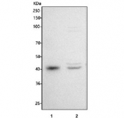 Western blot testing of human 1) SH-SY5Y and 2) HepG2 cell lysate with Islet 1 antibody. Predicted molecular weight ~39 kDa.