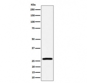 Western blot testing of human HepG2 cell lysate with Adenylate kinase 2 antibody. Predicted molecular weight ~26 kDa.