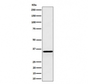 Western blot testing of human HepG2 cell lysate with Pyrophosphatase 1 antibody. Predicted molecular weight ~33 kDa.