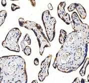 IHC staining of FFPE human placental tissue with HTT antibody. HIER: boil tissue sections in pH8 EDTA for 20 min and allow to cool before testing.