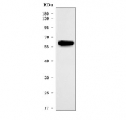 Western blot testing of human HaCaT cell lysate with Cytokeratin 4 antibody. Predicted molecular weight ~56 kDa.