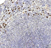 IHC staining of FFPE human spleen tissue with S100A12 antibody. HIER: boil tissue sections in pH8 EDTA for 20 min and allow to cool before testing.