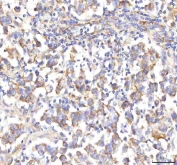 IHC staining of FFPE human testicular seminoma tissue with HSD17B13 antibody. HIER: boil tissue sections in pH8 EDTA for 20 min and allow to cool before testing.