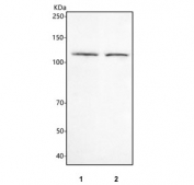 Western blot testing of human 1) HeLa and 2) K562 cell lysate with IPO8 antibody. Predicted molecular weight ~120 kDa.