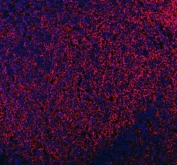 Immunofluorescent staining of FFPE human tonsil tissue with MRC1 antibody (red) and DAPI nuclear stain (blue). HIER: steam section in pH8 EDTA buffer for 20 min.