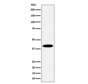 Western blot testing of human Raji cell lysate with PLEK antibody. Predicted molecular weight ~40 kDa.