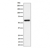 Western blot testing of human HeLa cell lysate with Regulator of G-protein signaling 6 antibody. Predicted molecular weight ~54 kDa.