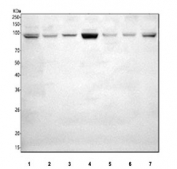 Western blot testing of 1) human HepG2, 2) rat stomach, 3) rat lung, 4) rat C6, 5) mouse stomach, 6) mouse lung and 7) mouse MFC cell lysate with SLC26A9 antibody. Predicted molecular weight ~87 kDa and ~97 kDa (two isoforms).