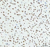 IHC staining of FFPE rat brain tissue with TARDBP antibody. HIER: boil tissue sections in pH8 EDTA for 20 min and allow to cool before testing.