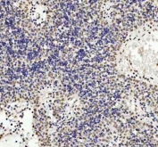 IHC staining of FFPE human spleen tissue with TARDBP antibody. HIER: boil tissue sections in pH8 EDTA for 20 min and allow to cool before testing.