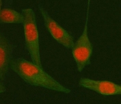 Immunofluorescent staining of FFPE human HeLa cells with TARDBP antibody (red) and Beta Tubulin mAb (green). HIER: steam section in pH6 citrate buffer for 20 min.