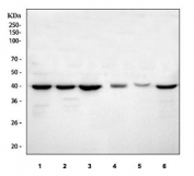 Western blot testing of 1) human HeLa, 2) human Jurkat, 3) human HepG2, 4) rat C6, 5) mouse pancreas and 6) mouse Neuro-2a cell lysate with TARDBP antibody. Predicted molecular weight ~45 KDa, commonly observed at 43-45 kDa.