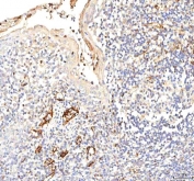 IHC staining of FFPE human tonsil tissue with Plakophilin 2 antibody. HIER: boil tissue sections in pH8 EDTA for 20 min and allow to cool before testing.