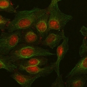 Immunofluorescent staining of FFPE human U-2 OS cells with Plakophilin 2 antibody (red) and Beta Tubulin mAb (green). HIER: steam section in pH6 citrate buffer for 20 min.