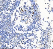 IHC staining of FFPE human tonsil tissue with MACROH2A2 antibody. HIER: boil tissue sections in pH8 EDTA for 20 min and allow to cool before testing.
