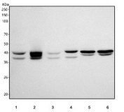 Western blot testing of 1) human HepG2, 2) human SH-SY5Y, 3) human PC-3, 4) human 293T, 5) rat brain and 6) mouse brain tissue lysate with MACROH2A2 antibody. Predicted molecular weight ~40 kDa with multiple smaller isoforms.