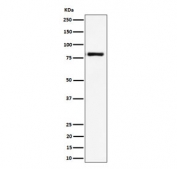 Western blot testing of human Raji cell lysate with LTK antibody. Predicted molecular weight: ~92 kDa, ~86 kDa, ~79 kDa and additional smaller isoforms.