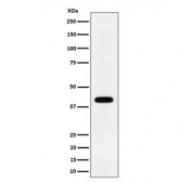 Western blot testing of human HeLa cell lysate with SCAD antibody. Predicted molecular weight ~44 kDa.