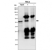 Immunoprecipitation of SCAD protein from 500ug of human HeLa whole cell lysate with SCAD antibody at 1:50. Western blot testing was done with SCAD antibody at 1:1000.