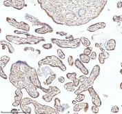 IHC staining of FFPE human placental tissue with MIPEP antibody. HIER: boil tissue sections in pH8 EDTA for 20 min and allow to cool before testing.