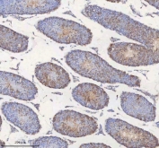 IHC staining of FFPE mouse testis tissue with MIPEP antibody. HIER: boil tissue sections in pH8 EDTA for 20 min and allow to cool before testing.