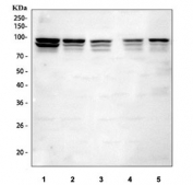 Western blot testing of 1) human K562, 2) human HeLa, 3) rat brain, 4) mouse brain and 5) mouse lung tissue lysate with PI4KB antibody. Predicted molecular weight ~91 kDa and ~89 kDa (two isoforms).