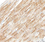 IHC staining of FFPE human skeletal muscle tissue with PI4KB antibody. HIER: boil tissue sections in pH8 EDTA for 20 min and allow to cool before testing.
