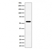 Western blot testing of human Jurkat cell lysate with RNF14 antibody. Predicted molecular weight ~54 kDa.