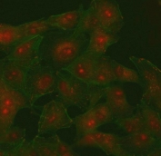 Immunofluorescent staining of FFPE human A549 cells with PI4K2B antibody (red) and Phalloidin-iFluor 488 conjugate (green). HIER: steam section in pH6 citrate buffer for 20 min.