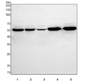 Western blot testing of 1) human Caco-2, 2) human 293T, 3) human Jurkat, 4) rat brain and 5) mouse brain tissue lysate with HDHD5 antibody. Predicted molecular weight ~46 kDa.