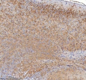 IHC staining of FFPE mouse cerebral cortex tissue with HDHD5 antibody. HIER: boil tissue sections in pH8 EDTA for 20 min and allow to cool before testing.