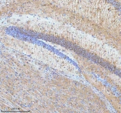IHC staining of FFPE mouse hippocampus tissue with HDHD5 antibody. HIER: boil tissue sections in pH8 EDTA for 20 min and allow to cool before testing.