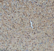 IHC staining of FFPE rat cerebral cortex tissue with HDHD5 antibody. HIER: boil tissue sections in pH8 EDTA for 20 min and allow to cool before testing.