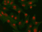 Immunofluorescent staining of FFPE human A549 cells with PHF6 antibody (red) and Phalloidin-iFluor 488 conjugate (green). HIER: steam section in pH6 citrate buffer for 20 min.