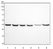 Western blot testing of 1) human HepG2, 2) human Caco-2, 3) human PC-3, 4) human K562, 5) rat lung and 6) rat liver tissue lysate with ACAT1 antibody. Predicted molecular weight ~45 kDa.