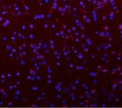 Immunofluorescent staining of FFPE rat brain tissue with Phosphoglucomutase 3 antibody (red) and DAPI nuclear stain (blue). HIER: steam section in pH8 EDTA buffer for 20 min.