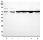 Western blot testing of 1) human 293T, 2) human HepG2, 3) rat liver, 4) rat kidney, 5) mouse liver and 6) mouse kidney tissue lysate with PCCA antibody. Predicted molecular weight: 75-80 kDa (multiple isoforms).