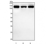 Western blot testing of human 1) PC-3, 2) SH-SY5Y and 3) HepG2 cell lysate with HDGFL2 antibody. Predicted molecular weight ~74 kDa, commonly observed at 74-120 kDa.
