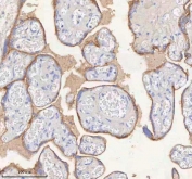IHC staining of FFPE human placental tissue with HER4 antibody. HIER: boil tissue sections in pH8 EDTA for 20 min and allow to cool before testing.