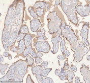 IHC staining of FFPE human placental tissue with HER4 antibody. HIER: boil tissue sections in pH8 EDTA for 20 min and allow to cool before testing.