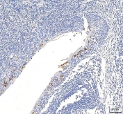 IHC staining of FFPE human tonsil tissue with PKDCC antibody. HIER: boil tissue sections in pH8 EDTA for 20 min and allow to cool before testing.