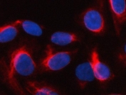Immunofluorescent staining of FFPE human U-2 OS cells with PKDCC antibody (red) and DAPI nuclear stain (blue). HIER: steam section in pH6 citrate buffer for 20 min.