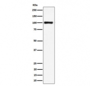 Western blot testing of human HeLa cell lysate with NCL antibody. Predicted molecular weight ~77 kDa, commonly observed at 100~110 kDa.
