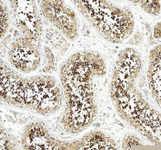 IHC staining of FFPE human testis tissue with HSPA4L antibody, HRP-secondary and DAB substrate. HIER: boil tissue sections in pH8 EDTA for 20 min and allow to cool before testing.