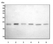 Western blot testing of 1) human 293T, 2) human MCF7, 3) human HT-1080, 4) human HeLa, 5) rat thymus and 6) mouse thymus tissue lysate with RMI2 antibody. Expected molecular weight ~18 kDa.