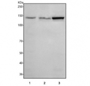 Western blot testing of human 1) 293T, 2) Jurkat and 3) HEL cell lysate with Puratrophin 1 antibody. Predicted molecular weight ~131 kDa.