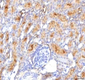 IHC staining of FFPE rat kidney tissue with HSDL2 antibody. HIER: boil tissue sections in pH8 EDTA for 20 min and allow to cool before testing.
