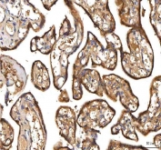 IHC staining of FFPE human placental tissue with Peptide deformylase antibody. HIER: boil tissue sections in pH8 EDTA for 20 min and allow to cool before testing.